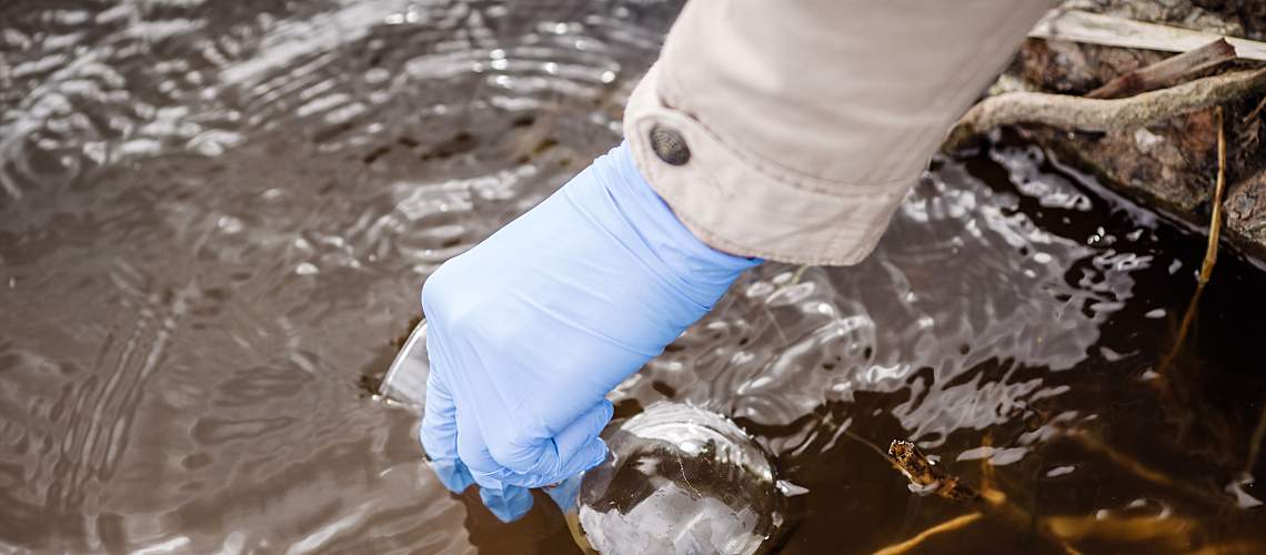 A hand in glove collects a water sample to test for cholera.