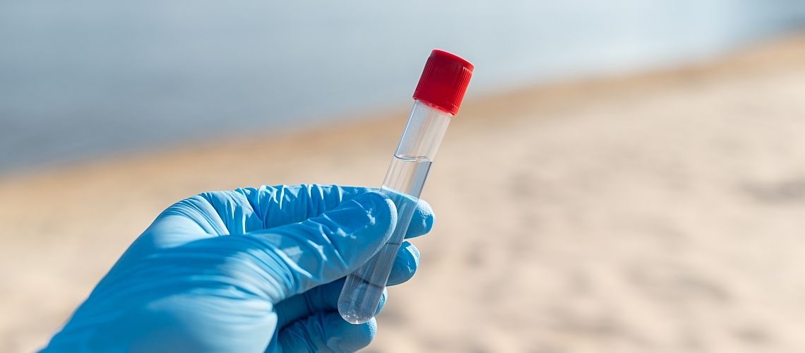 A gloved hand holds a water sample on a river beach.