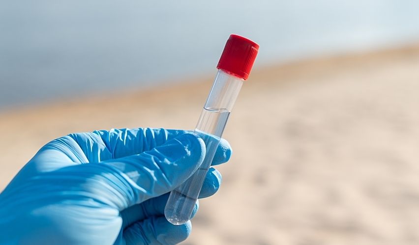 A gloved hand holds a water sample on a river beach.