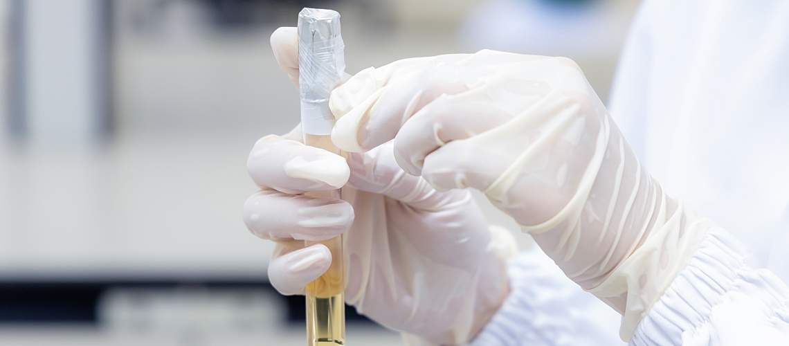 A gloved hand holding taped vial sample.